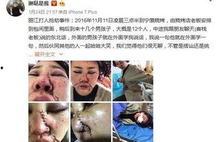 爆料博主毁容事件真相视频,爆料博主遭遇的惊人内幕 第1张 爆料博主毁容事件真相视频,爆料博主遭遇的惊人内幕 第1张